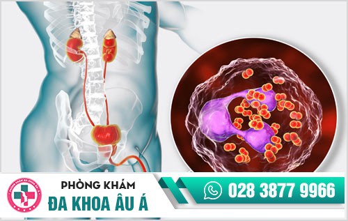 nguyên nhân bệnh lậu ở nam giới nguyên nhân bệnh lậu ở nam giới