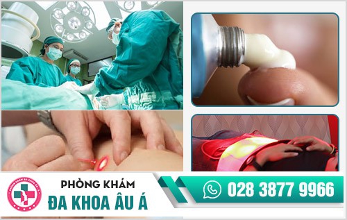 thuốc chữa trị hạt ngọc dương vật thuốc chữa trị hạt ngọc dương vật