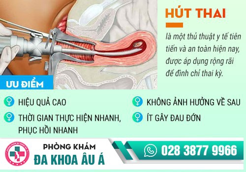 Phá thai bằng ống dẫn siêu 