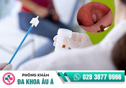 Xét nghiệm sùi mào gà bằng mẫu dịch