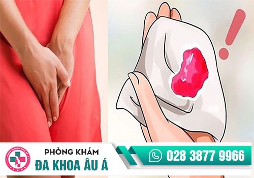 KHI NÀO MÁU BÁO THAI ĐƯỢC XEM LÀ BẤT THƯỜNG?
